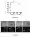 Fig. 20 - METHODS AND COMPOSITIONS FOR TREATING CANCER