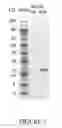 Fig. 02 - Methods of treatment for retinal diseases using MANF and CNDF