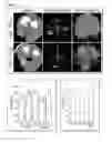 Fig. 19 - Antibody which binds Lrg1 and methods of use
