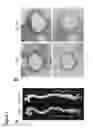 Fig. 02 - Aortopathy