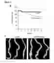 Fig. 06 - Aortopathy