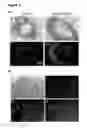 Fig. 22 - Aortopathy
