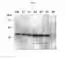 Fig. 04 - Multiple variants of meningococcal protein NMB1870
