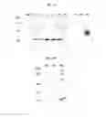 Fig. 05 - Multiple variants of meningococcal protein NMB1870