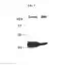 Fig. 06 - Multiple variants of meningococcal protein NMB1870