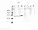 Fig. 08 - Multiple variants of meningococcal protein NMB1870