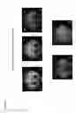 Fig. 09 - TARGETED NANOPARTICLES