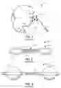 Fig. 02 - Recovery Catheter Assembly and Method