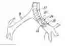 Fig. 01 - Apparatus for treating asthma using neurotoxin