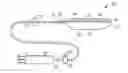 Fig. 01 - Intracavity balloon catheter and method of use