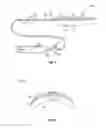 Fig. 02 - Intracavity balloon catheter and method of use
