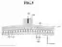 Fig. 04 - DRY ELECTRODE