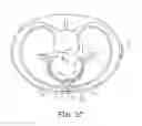 Fig. 06 - Cardiac electrical signal morphology and pattern-based T-wave oversensing rejection