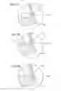 Fig. 08 - Striking face deflection structures in a golf club