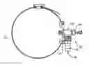Fig. 01 - FLUID EXTRACTOR DEVICE AND KIT