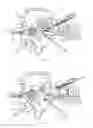 Fig. 06 - WINDING/UNWINDING DEVICE AND METHOD FOR WINDING/UNWINDING A METAL PRODUCT IN A ROLLING LINE