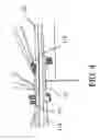Fig. 05 - Stabilizing structure for a trailer