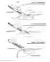 Fig. 16 - System and method for mounting a specimen on a slide
