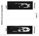 Fig. 05 - Compositions and methods for treating fatty tissue buildup