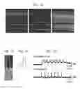 Fig. 02 - GENE THERAPY TO IMPROVE VISION