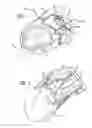 Fig. 02 - Portable dialysis drainage system and method