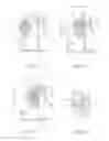 Fig. 08 - Leaf unit of a scissor mechanism of a fitting and method for installing such a leaf unit