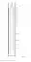 Fig. 02 - Downhole stroking tool