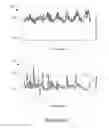 Fig. 06 - Storage anomaly detection