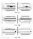 Fig. 09 - Genetic copy number alteration classifications