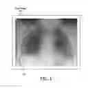 Fig. 02 - Method and system for context-sensitive assessment of clinical findings