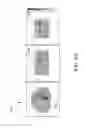 Fig. 08 - Intra reconstruction motion correction