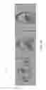 Fig. 11 - Intra reconstruction motion correction