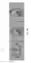 Fig. 12 - Intra reconstruction motion correction