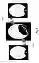 Fig. 07 - Systems and methods for rendering effects in 360 video