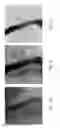 Fig. 02 - Method, device and system for simulating shadow images