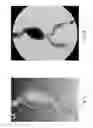 Fig. 03 - Method, device and system for simulating shadow images