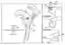 Fig. 01 - SYSTEM OF PREOPERATIVE PLANNING AND PROVISION OF PATIENT-SPECIFIC SURGICAL AIDS