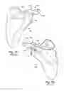 Fig. 02 - SYSTEM OF PREOPERATIVE PLANNING AND PROVISION OF PATIENT-SPECIFIC SURGICAL AIDS