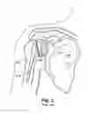 Fig. 04 - SYSTEM OF PREOPERATIVE PLANNING AND PROVISION OF PATIENT-SPECIFIC SURGICAL AIDS