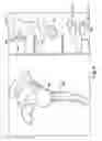Fig. 10 - SYSTEM OF PREOPERATIVE PLANNING AND PROVISION OF PATIENT-SPECIFIC SURGICAL AIDS