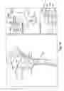 Fig. 12 - SYSTEM OF PREOPERATIVE PLANNING AND PROVISION OF PATIENT-SPECIFIC SURGICAL AIDS