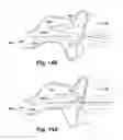 Fig. 16 - SYSTEM OF PREOPERATIVE PLANNING AND PROVISION OF PATIENT-SPECIFIC SURGICAL AIDS