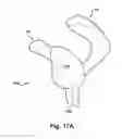 Fig. 20 - SYSTEM OF PREOPERATIVE PLANNING AND PROVISION OF PATIENT-SPECIFIC SURGICAL AIDS