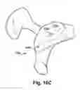 Fig. 23 - SYSTEM OF PREOPERATIVE PLANNING AND PROVISION OF PATIENT-SPECIFIC SURGICAL AIDS