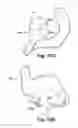 Fig. 24 - SYSTEM OF PREOPERATIVE PLANNING AND PROVISION OF PATIENT-SPECIFIC SURGICAL AIDS