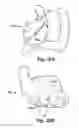 Fig. 25 - SYSTEM OF PREOPERATIVE PLANNING AND PROVISION OF PATIENT-SPECIFIC SURGICAL AIDS