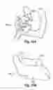 Fig. 26 - SYSTEM OF PREOPERATIVE PLANNING AND PROVISION OF PATIENT-SPECIFIC SURGICAL AIDS