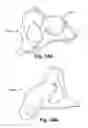 Fig. 30 - SYSTEM OF PREOPERATIVE PLANNING AND PROVISION OF PATIENT-SPECIFIC SURGICAL AIDS