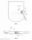 Fig. 02 - Mounting device for an elongate flexible member