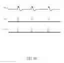 Fig. 12 - Signal modulation method and signal rectification and modulation device